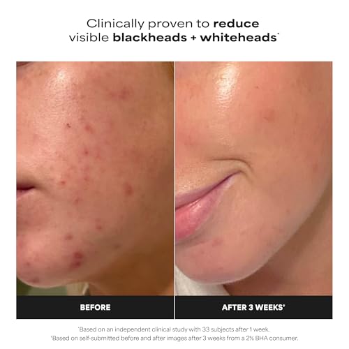 Paula's Choice SKIN PERFECTING 2% BHA Liquid Exfoliant with Salicylic Acid, Facial Polish for Pores, Wrinkles & Fine Lines, Suitable for Blackhead-Prone Skin, Fragrance-Free