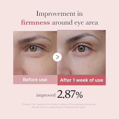 medicube Eye Serum with Salmon DNA PDRN & Pink Peptides | 99% Purity Retinol for Fine Lines | PDRN & Niacinamide for Uneven Skin Tone | Korean Skincare, 1.01 fl.oz