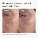 The Ordinary Glycolic Acid 7% Exfoliating Toner, Brightening and Smoothing Daily Toner for More Even-Looking Skin Tone
