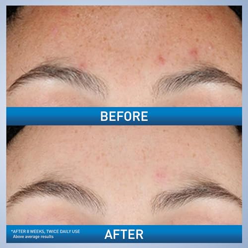 CeraVe Resurfacing Retinol Serum For Post Acne Marks