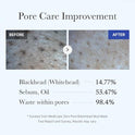 Medicube Zero Pore Blackhead Mud Facial Mask - Skin Cooling & Pore Tightening - 3 Minute Quick Dry Formula with AHA, BHA, PHA, and Pore-Purifying Clay - Korean Mud Mask 3.52 oz