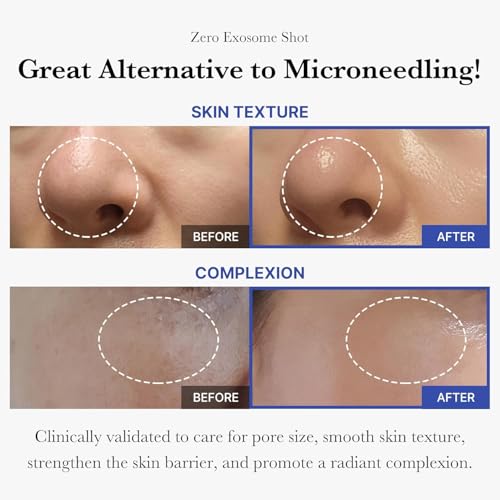 medicube Exosome Shot Zero 2,000 PPM Spicule Facial Serum | Liquid Skin Booster Serum | Exosome, AHA+BHA+PHA | Pore Care, Dead Skin Cells, Skin Texture | Korean Skincare, 1.01 fl.oz