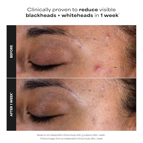 Paula's Choice SKIN PERFECTING 2% BHA Liquid Exfoliant with Salicylic Acid, Facial Polish for Pores, Wrinkles & Fine Lines, Suitable for Blackhead-Prone Skin, Fragrance-Free