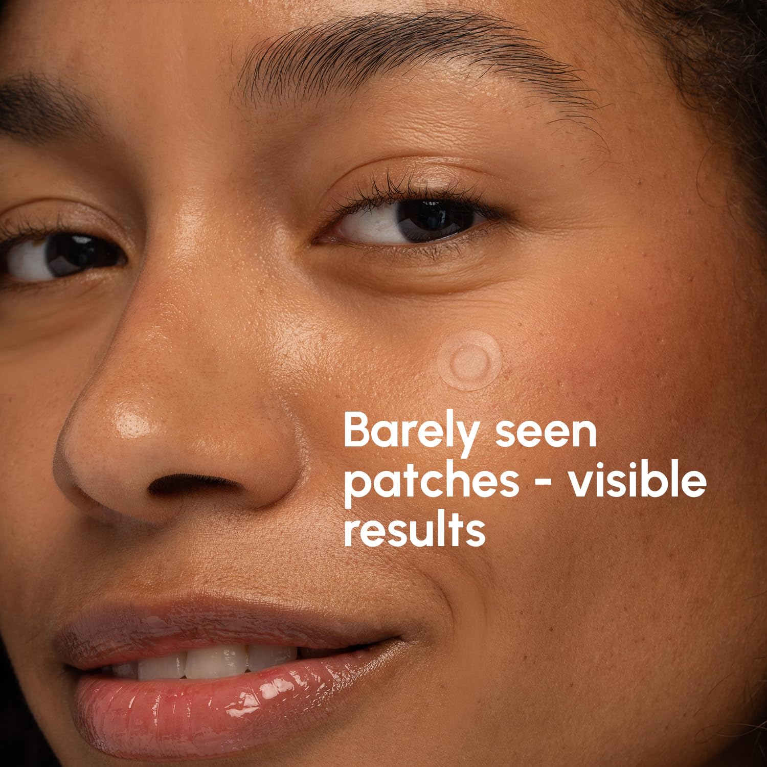 MAREE Pimple Patches for Face - Acne Clearing Device - Clear Acne Patches for Face - Invisible Hydrocolloid Patch Parches Para Acne Stickers Zit Dots - Cystic Zit Healing Blemish Pinple Covers