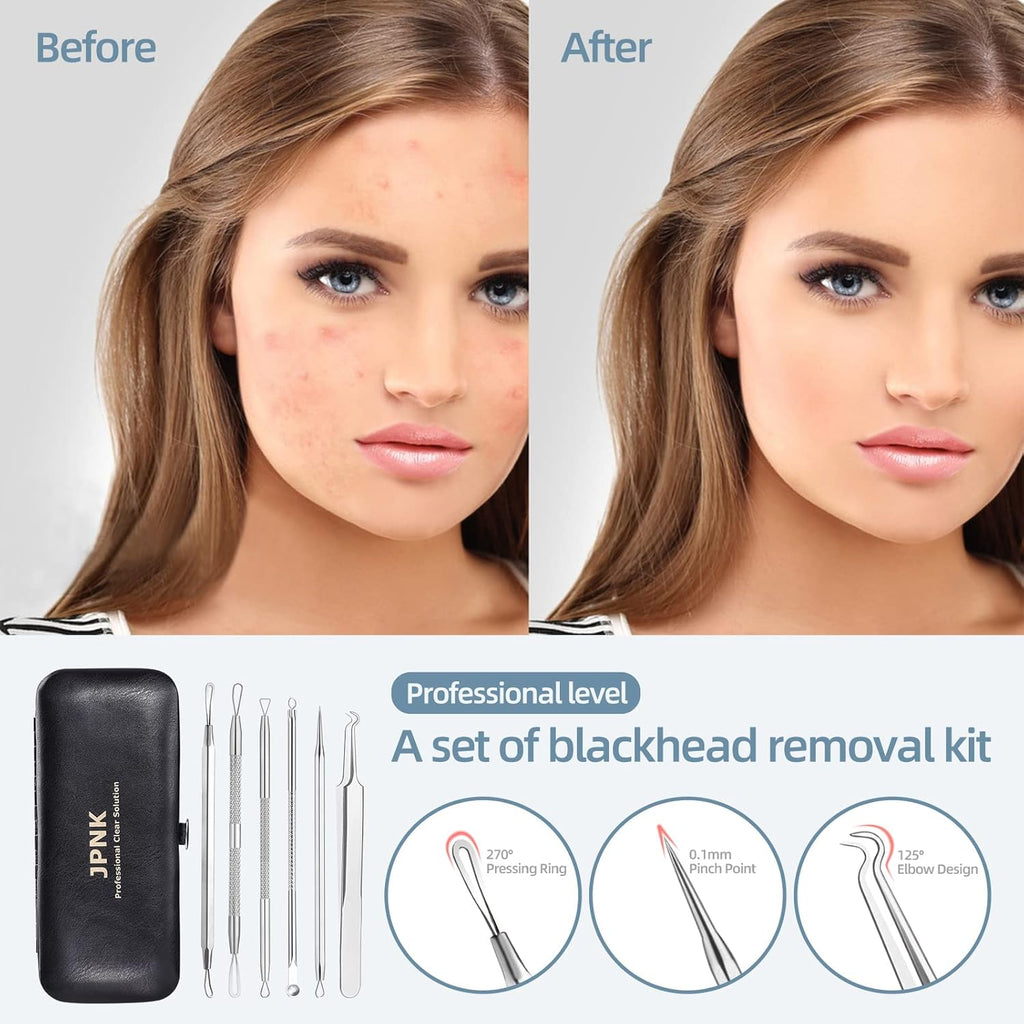 JPNK Blackhead Remover Tool Comedones Extractor Acne Removal Kit for Blemish, Whitehead Popping, 6 Pcs Zit Removing for Nose Face Tools with a Leather Bag