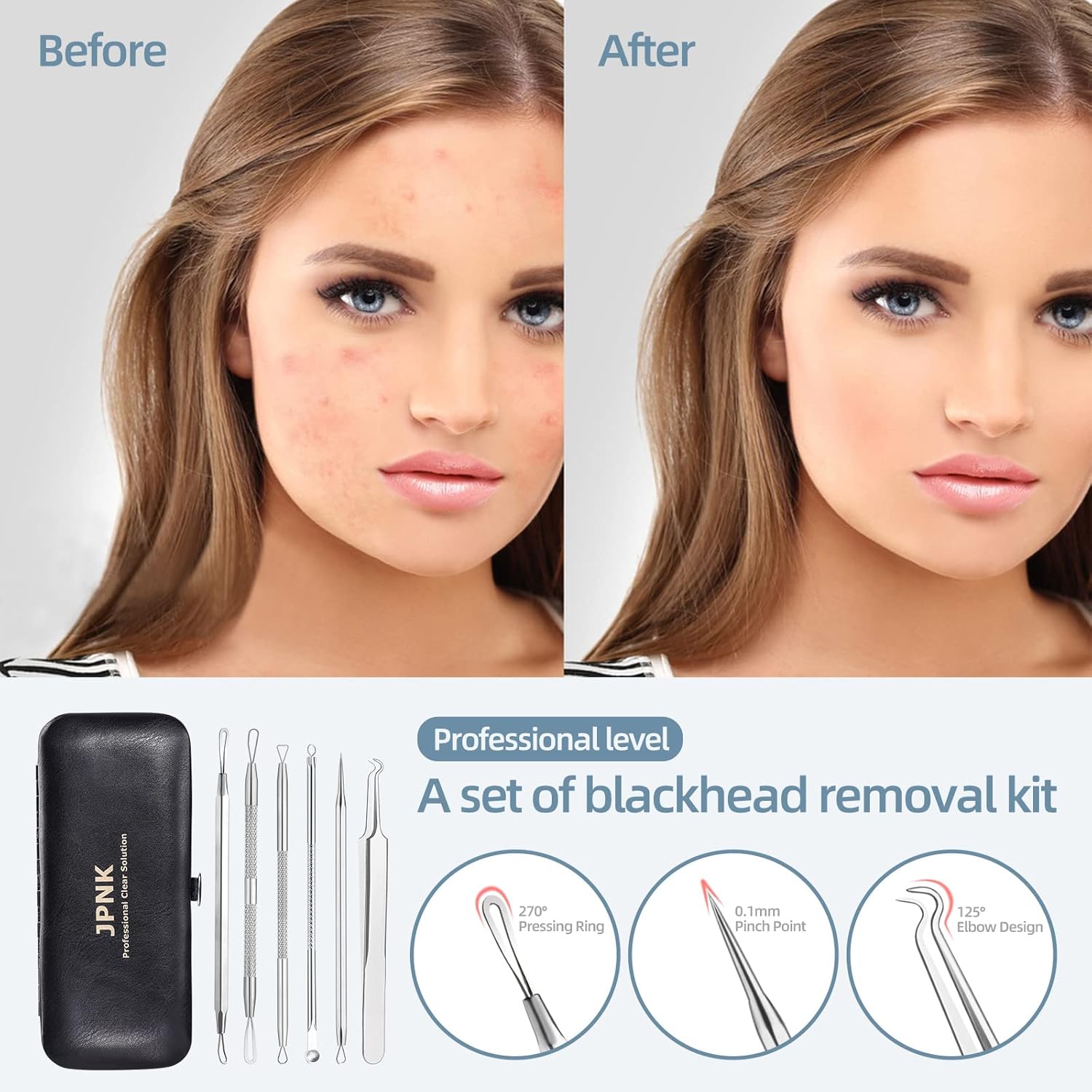 JPNK Blackhead Remover Tool Comedones Extractor Acne Removal Kit for Blemish, Whitehead Popping, 6 Pcs Zit Removing for Nose Face Tools with a Leather Bag