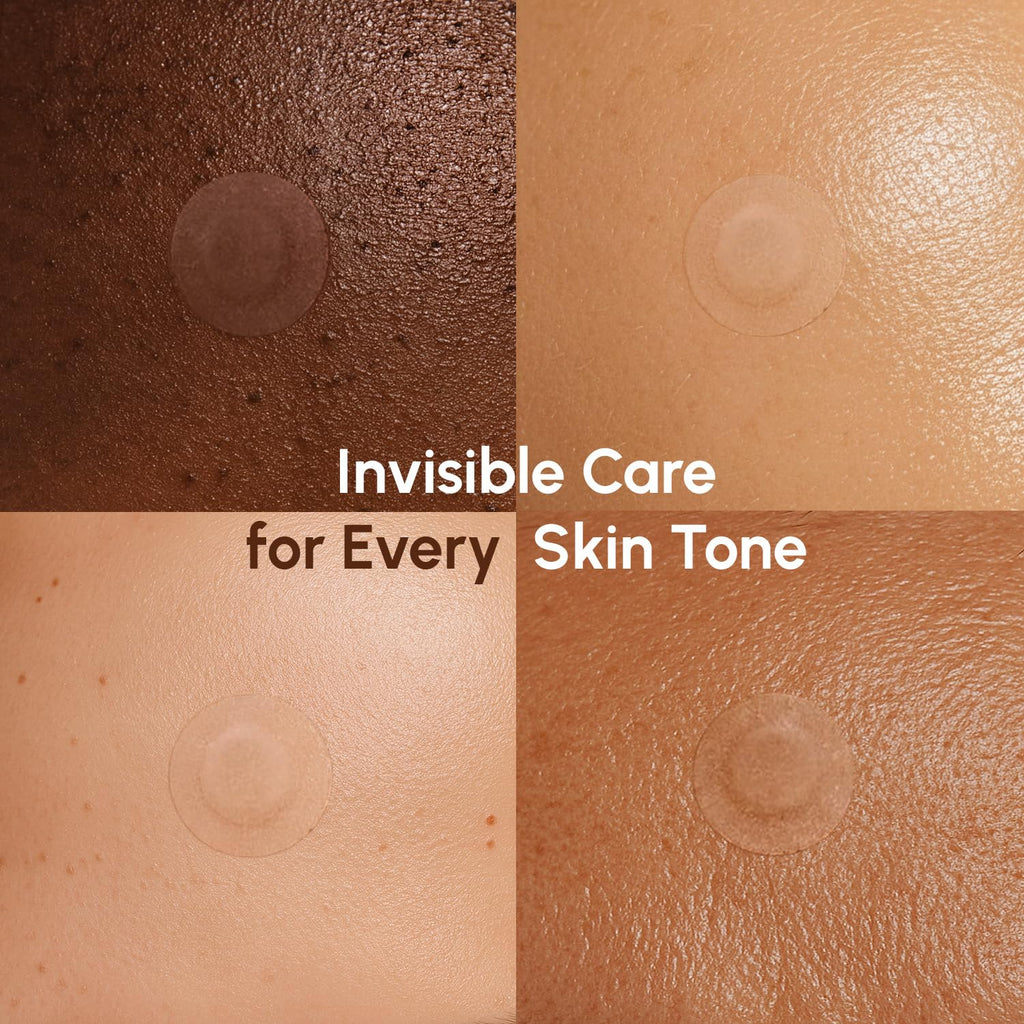 MAREE Pimple Patches for Face - Acne Clearing Device - Clear Acne Patches for Face - Invisible Hydrocolloid Patch Parches Para Acne Stickers Zit Dots - Cystic Zit Healing Blemish Pinple Covers