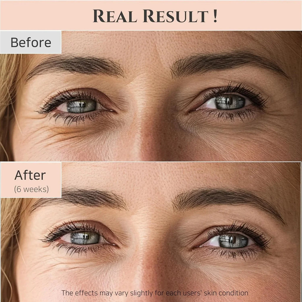 Joseon Revive Eye Serum with Retinal & Niacinamide for Puffy Eyes, Wrinkles, Dark Circles - Cart Shape